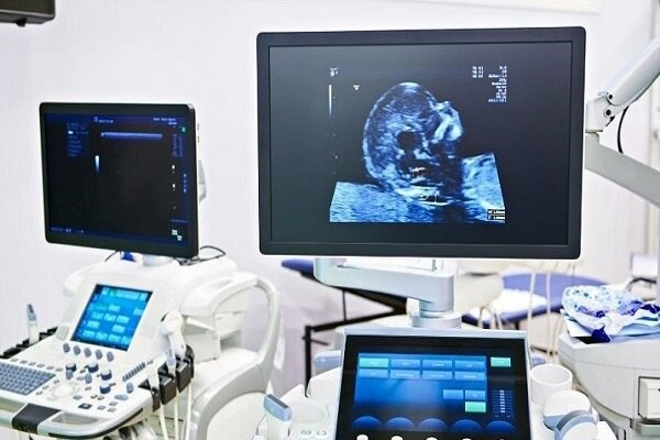 علائم هشداردهنده سرطان‌های زنان را نباید نادیده گرفت