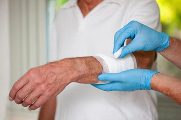 پژوهش درباره نسل جدید پانسمان‌ها؛ درمان زخم‌های عفونی متحول می‌شود